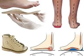 ortopedické boty pro hallux valgus u dítěte