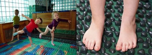 Gymnastika pro deformaci Valgus